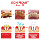 Sp-4 probiotic whitening toothpaste, Teeth Whitener Toothpaste, Natural Tooth Whitener (BUY 1 GET 1 FREE)