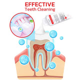 Sp-4 probiotic whitening toothpaste, Teeth Whitener Toothpaste, Natural Tooth Whitener (BUY 1 GET 1 FREE)